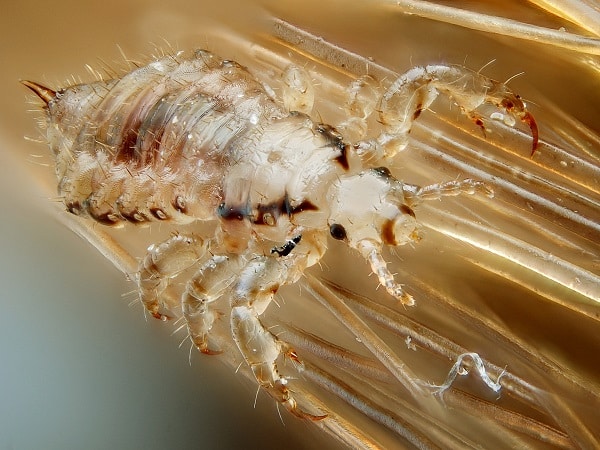 Hóa giải muộn phiền khi tình cờ trông thấy con chấy?